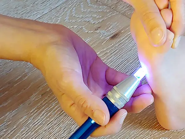 Penna per cronoterapia
